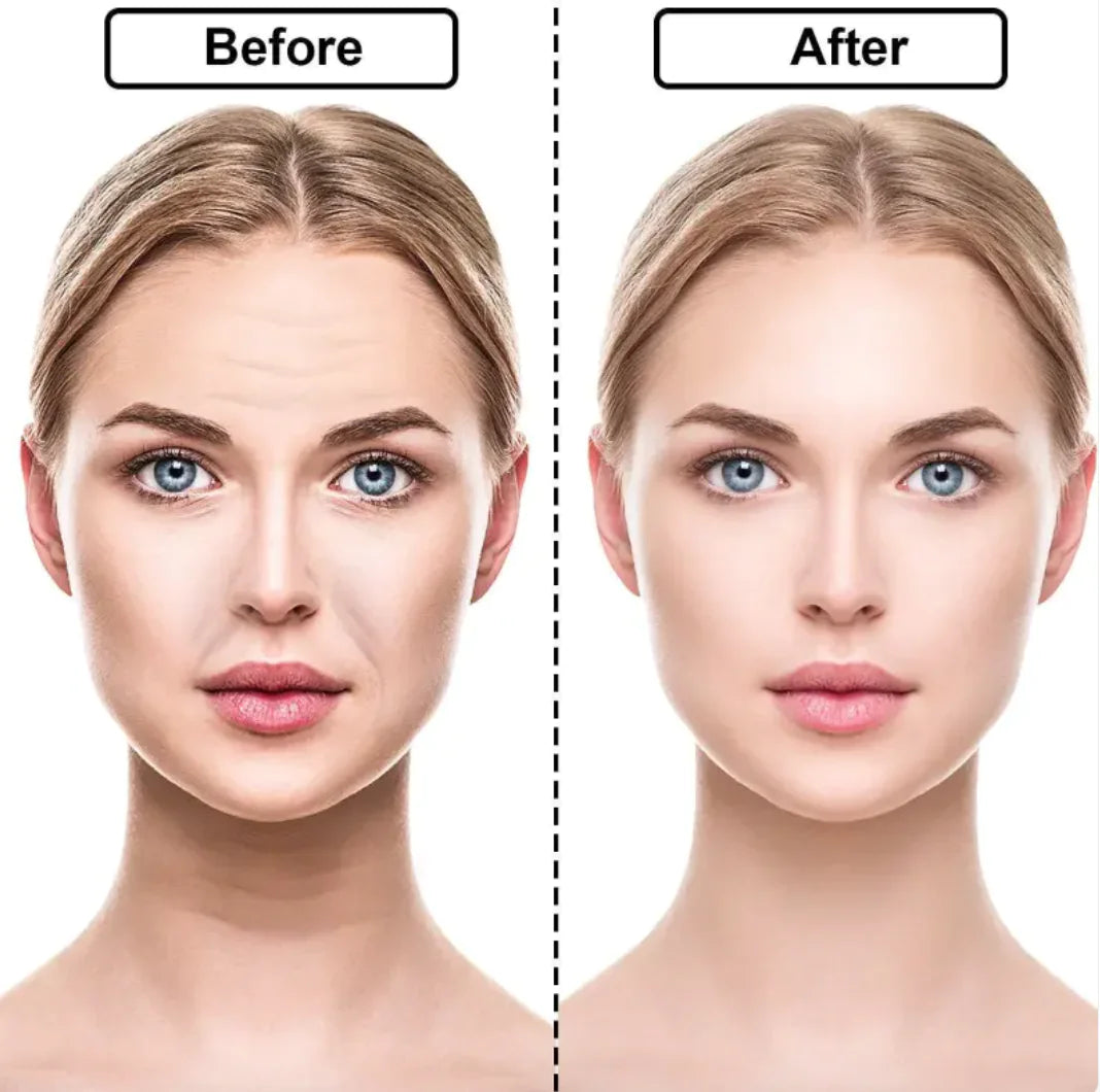 DermaGlo™ Anti-Wrinkle Collagen Mask Set